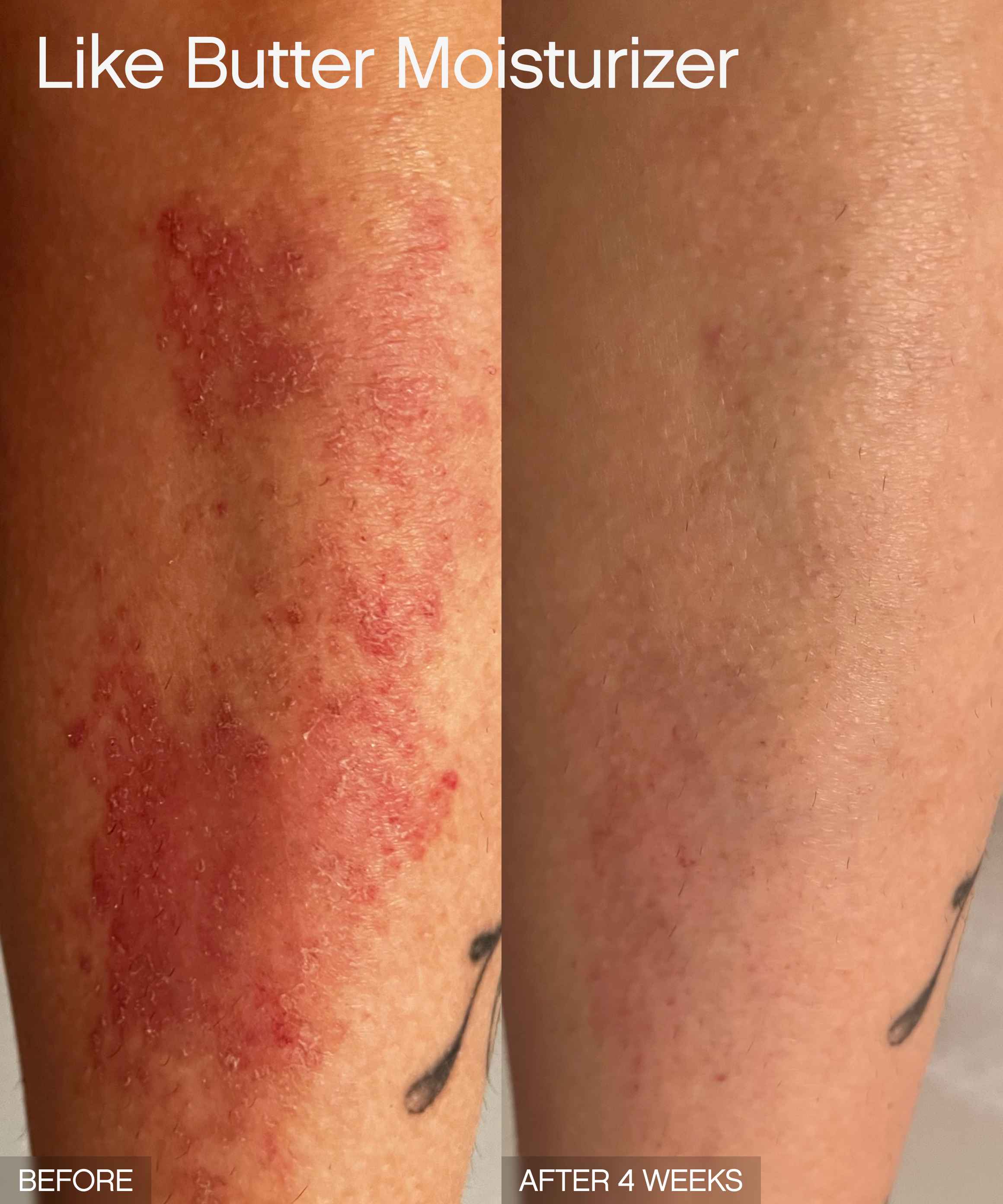 Discoloration Duo